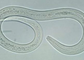 Couple Gets Worms in Feet From Walking on Beach Worm in feet