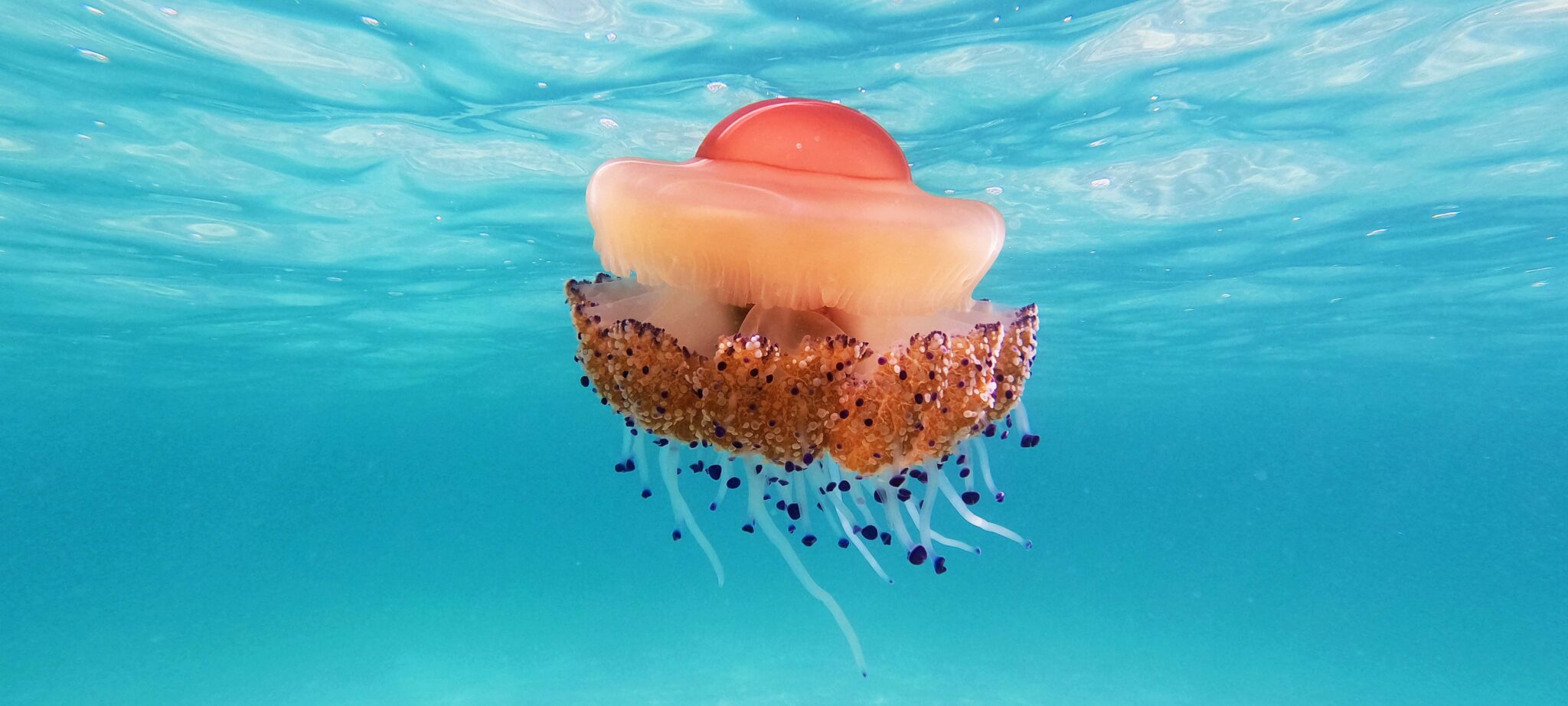 Jellyfish Stings 21 Important Tips for Preventing, Treating